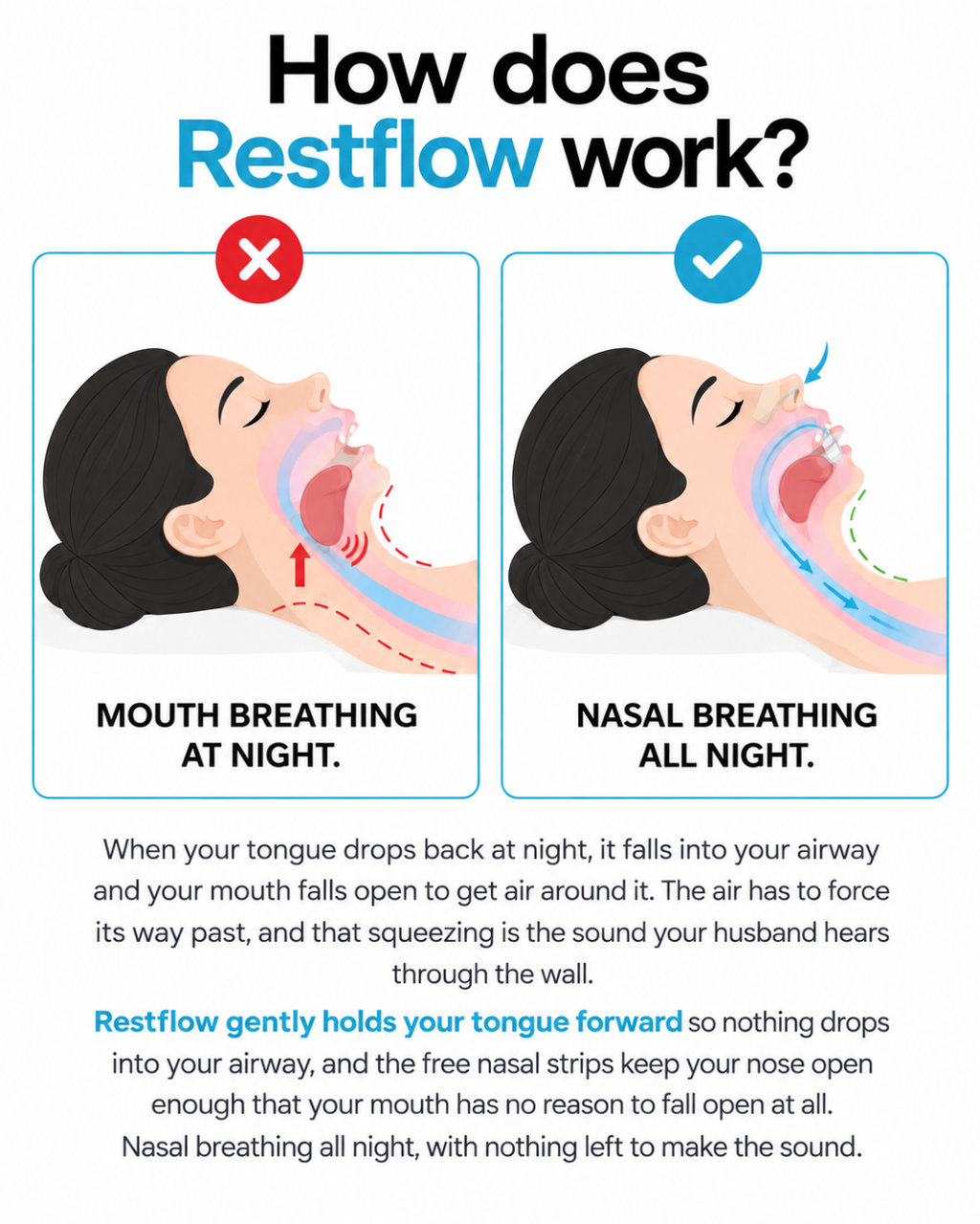 Restflow Tongue Positioning Retainer